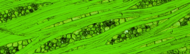 Erythroxylum areolatum green